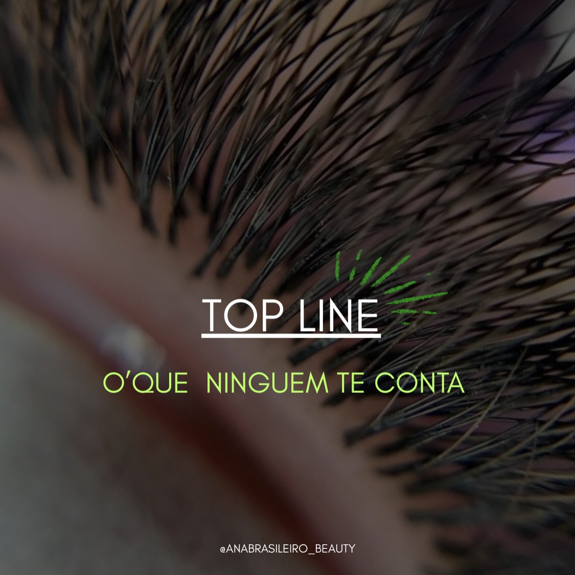 Epilação Facial COMPLETA